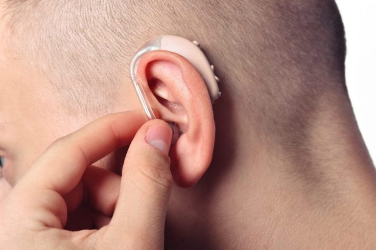 What is a retroauricular hearing device and when should you use it?
